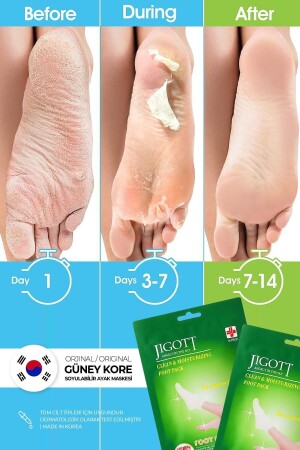 Çorap Tipi Soyulan Ayak Peeling Maskesi - Miracle Foot Peeling Pack 8809541280115 - 1