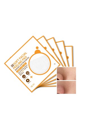 Face Peeling 5'li 1518136 - Mjcare
