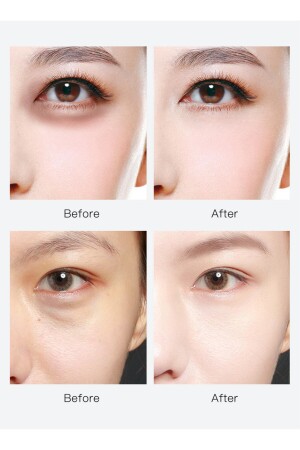 ® Göz Maskesi Exclusive Series Amino Asit Aydınlatıcı Kaz Ayağı Karşıtı 60 Adet 30806 - 3