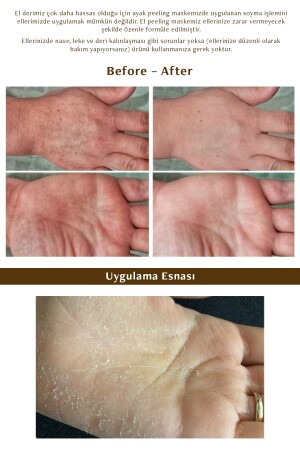 Hand Peeling - Soyulan El Peeling Maskesi 1518120 - 3