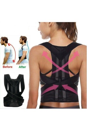 Medizinisches Bügel-Korsett für aufrechte Haltung, Rücken-Taille, für Damen und Herren, Anti-Buckel-Sportler-Korsett mit aufrechter Haltung FS-KORS-001 - 1