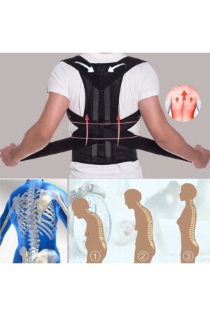 Medizinisches Bügel-Korsett für aufrechte Haltung, Rücken-Taille, für Damen und Herren, Anti-Buckel-Sportler-Korsett mit aufrechter Haltung FS-KORS-001 - 2